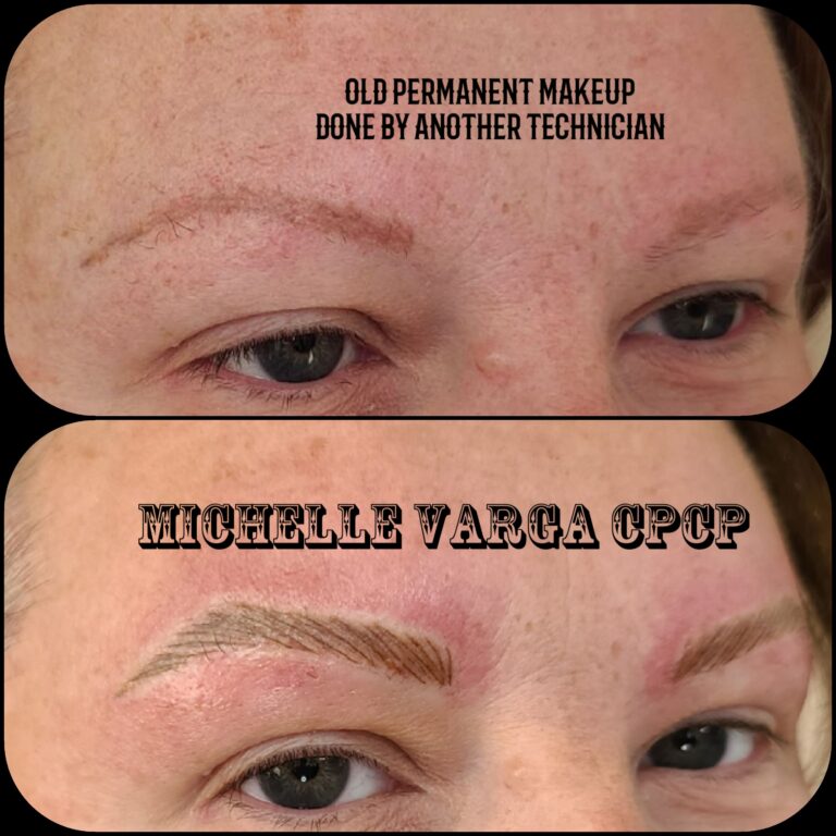 Alopecia clients 2